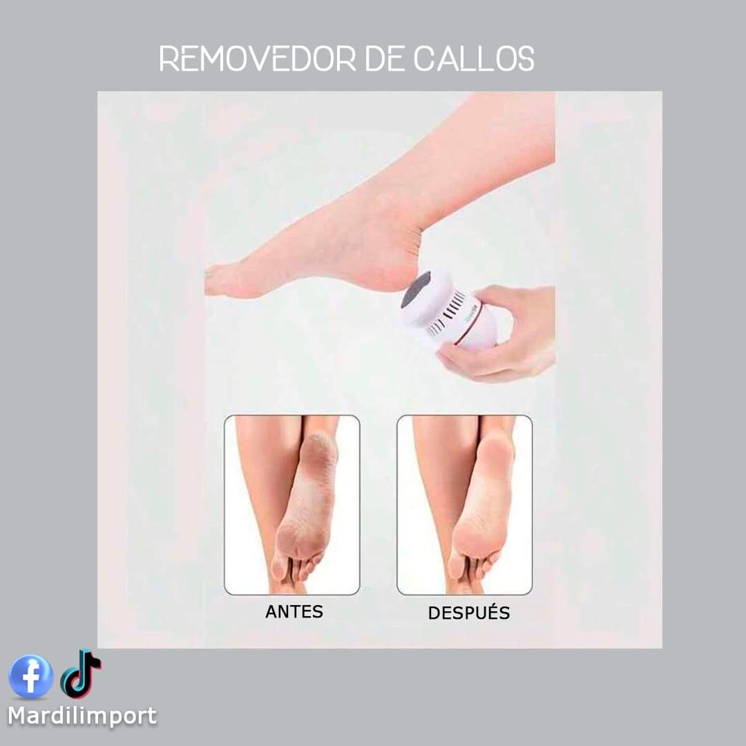 Removedor de Callos